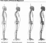 Images of How To Straighten The Spine
