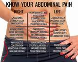 Images of Abdominal Pain Diagram