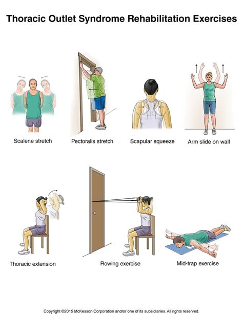 thoracic outlet syndrome exercises tufts medical center community care