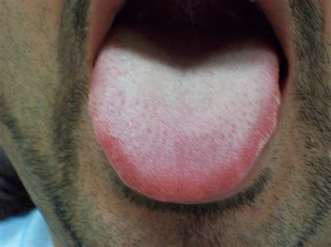 tongue check  health