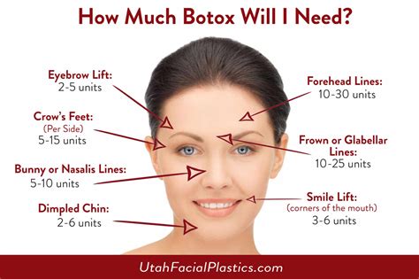 how much botox will i need utah facial plastics