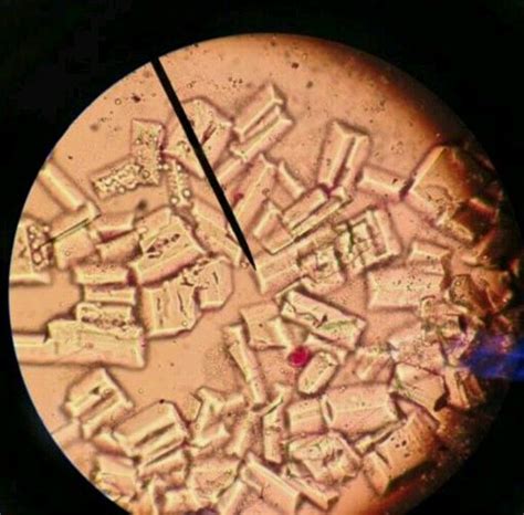 triple phosphate urine crystals imagens fofinhas