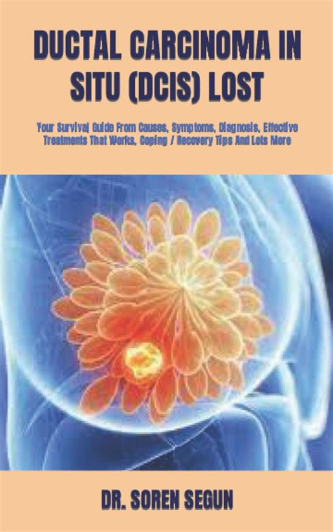 Ductal Carcinoma In Situ Dcis Lost Your Survival Guide From Causes