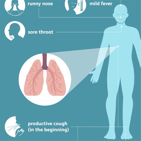 bronchitis symptoms signs and complications