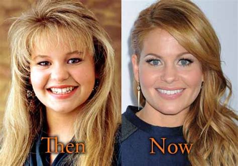 Candace Cameron Plastic Surgery Before And After Botox