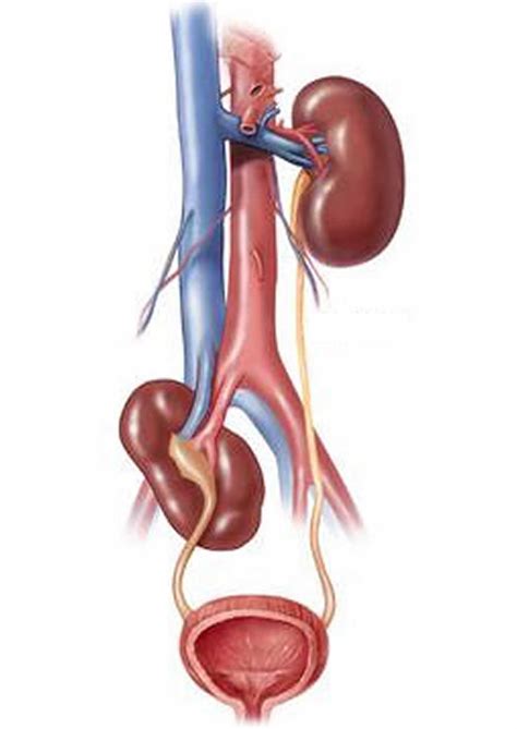 ectopic kidney renal ectopia  symptoms diagnosis treatment