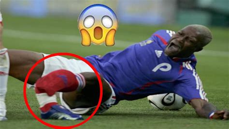 worst injuries  broken leg  football top  ft cisse eduardo youtube