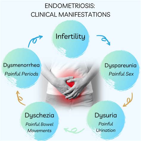understanding endometriosis unveiling  common symptoms