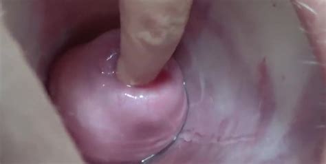 its porn extreme cervix playing with insertion metal chain in uterus