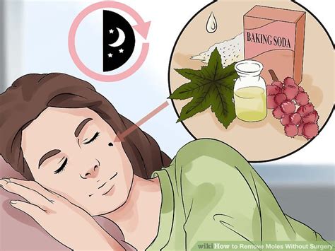 how to remove moles without surgery with pictures wikihow