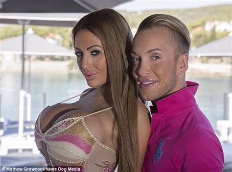 Barbie And Ken Obsessed Couple Spend £200k On Cosmetic Surgery To Look
