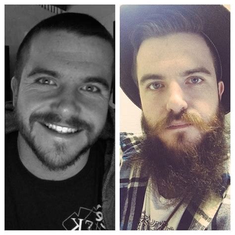 Before And After Photos Prove Men Always Look Better With Beards