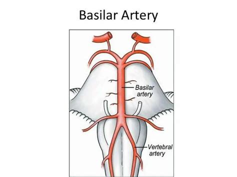 pictures  basilar artery