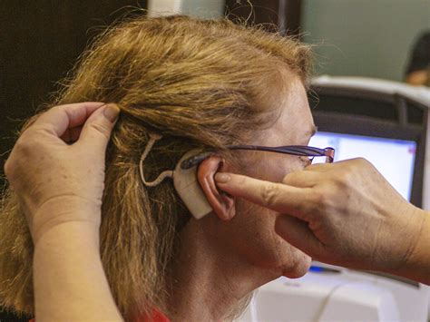 Cochlear Implants Portal Athens Oconee Audiology