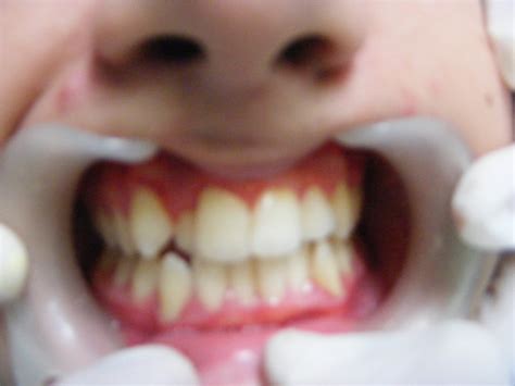 Orthodontic Treatment Stephanie Dental Clinic