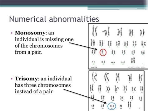 Chromosomal Abnormalities