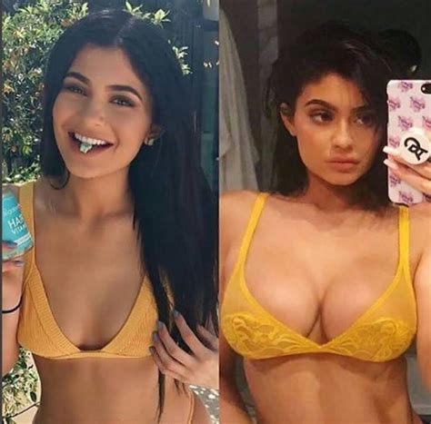 Photos Kylie Jenner Sparks Cosmetic Surgery Rumors With