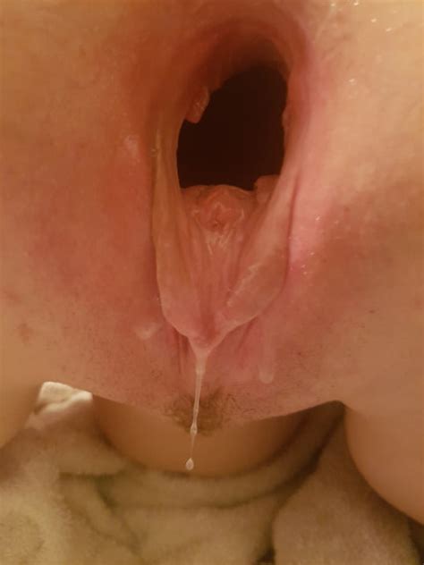 huge gaping pussy 61 pics