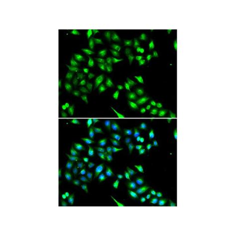 Anti Mouse C8orf79 Kiaa1456 Polyclonal Antibody Rabbit