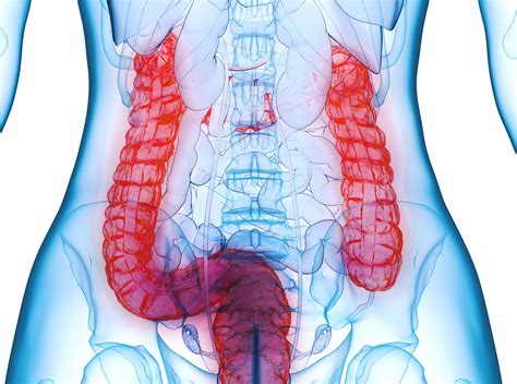 increased intestinal permeability     crohn disease gastroenterology advisor