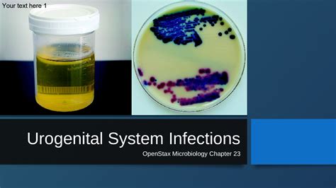 Openstax Microbiology Chapter 23 Urogenital System Infections