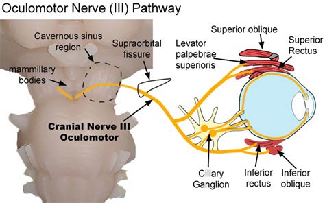 oculomotor nerve location function oculomotor nerve palsy damage
