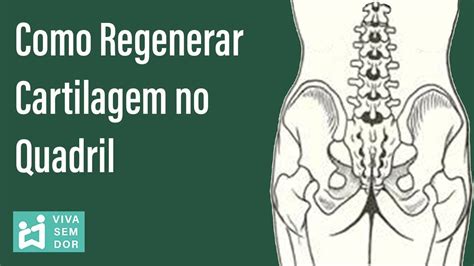 como regenerar cartilagem no quadril dor no quadril