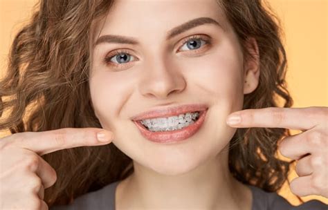 Tooth Coloured Braces Liverpool Smile With Teeth Straightening Pall