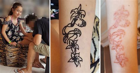 girl s temporary black henna tattoo turns into oozing burn that could