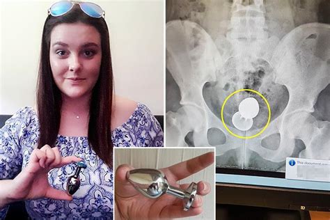 Woman Reveals How She Almost Needed A Colostomy Bag After Getting Four