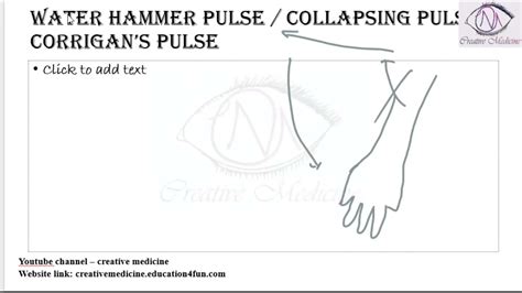 lec  water hammer pulse  collapsing pulse  corrigans pulse cardiology youtube