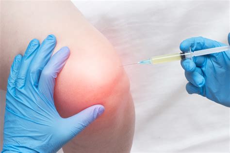 a new look at steroid injections for knee and hip osteoarthritis