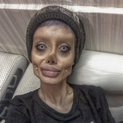This 19 Year Old Woman Has Had 50 Operations To Look Like