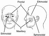 Sinus Sinuses Paranasal Medical Definition Dorland 2000 sketch template