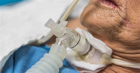advanced airway techniques  patients breathe easier