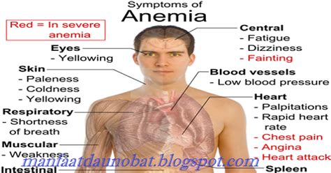 mengatasi anemia   alami  pengobatan