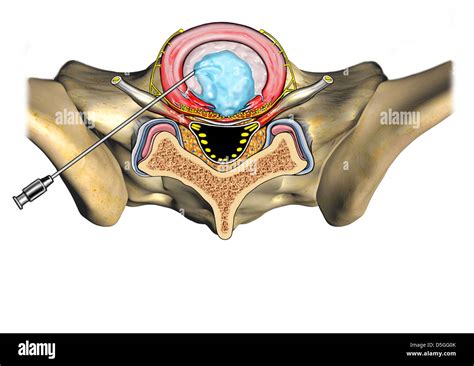 discography axial view stock photo alamy
