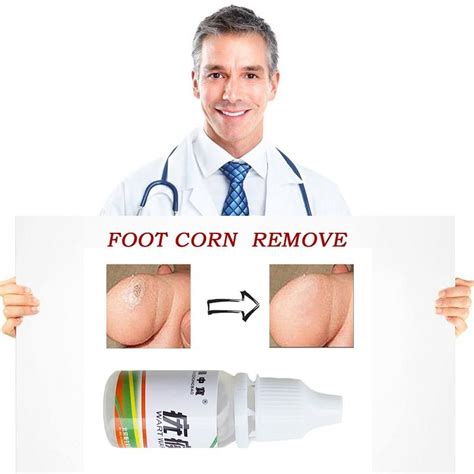 buy skin tag remover mexten product is of high quality