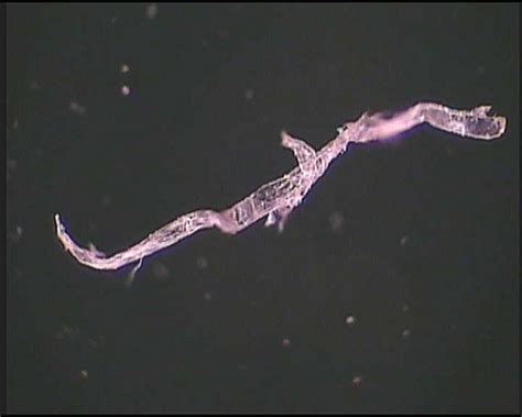 parasitesworms archives jills home remedies