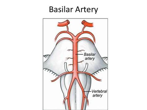 pictures  basilar arteryhealthiack
