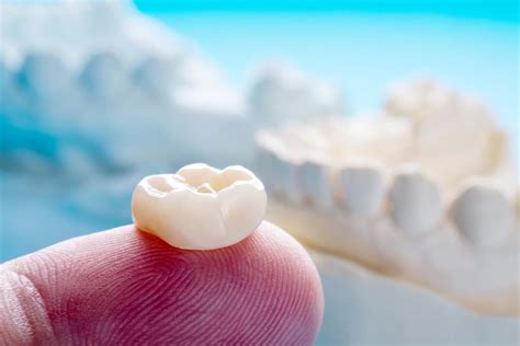 prosthetic teeth options  tx general dentistry beaumont