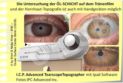 d blick auf meibomdrÜsen — ocular surface center berlin