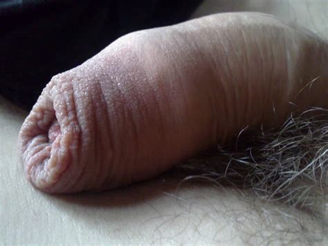 Soft And Small Uncut Cocks 2 300 Pics Xhamster