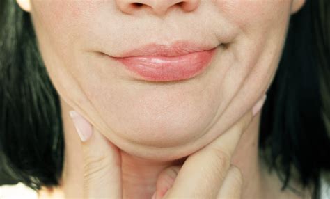 double chin  treatment options atlanta face  body