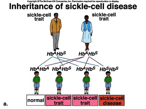 What Is Required For A Person To Have Sickle Cell Disease A The