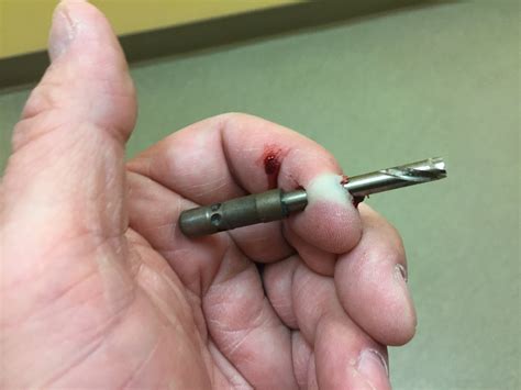 ot so i drilled a hole in my finger today page 2 ford truck