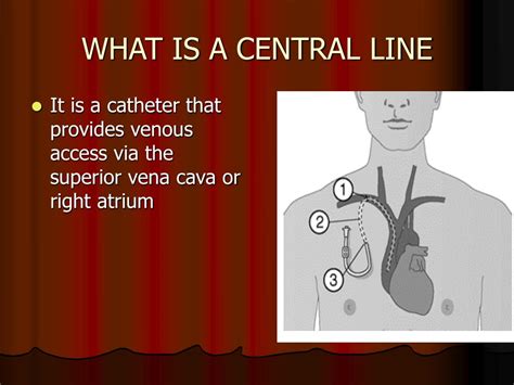 central lines  arterial lines powerpoint