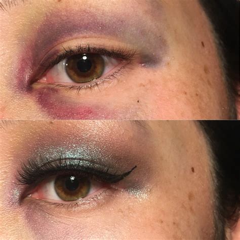 attempted   kind  black eye coverup makeupaddiction