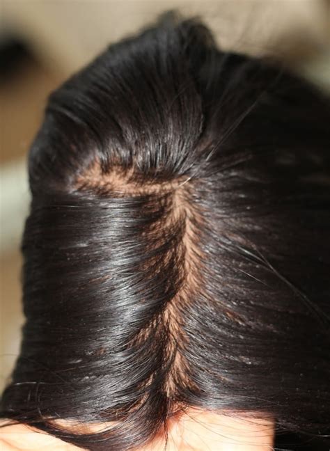 silk base closure  silk base frontals extreme hair addiction