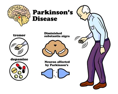 parkinsons disease   stopped